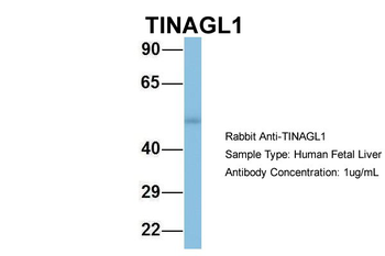 TINAGL1 Rabbit Polyclonal Antibody
