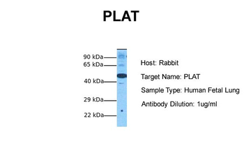 PLAT Rabbit Polyclonal Antibody