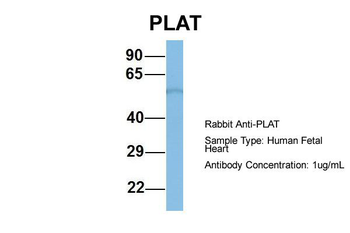 PLAT Rabbit Polyclonal Antibody