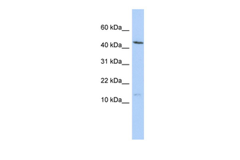MYL6 Rabbit Polyclonal Antibody