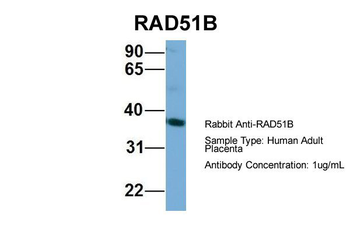 RAD51L1 Rabbit Polyclonal Antibody