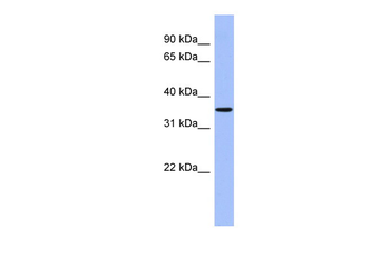 PPM1A Rabbit Polyclonal Antibody