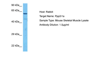 PPP2R1A Rabbit Polyclonal Antibody