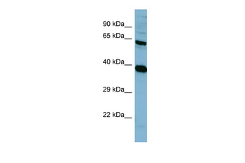 PPP2R1A Rabbit Polyclonal Antibody
