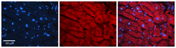 PKM2 Rabbit Polyclonal Antibody