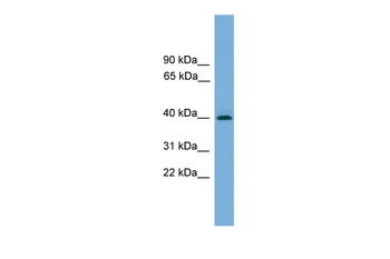 SERPINB8 Rabbit Polyclonal Antibody
