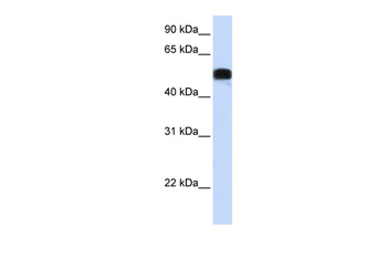 FOXA1 Rabbit Polyclonal Antibody