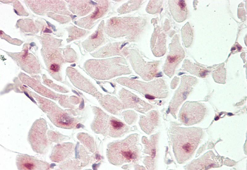 PROX1 Rabbit Polyclonal Antibody