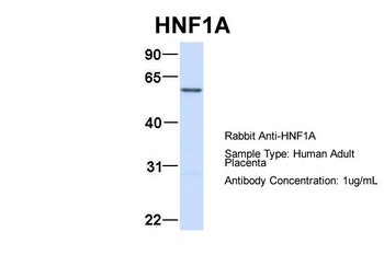 HNF1A Rabbit Polyclonal Antibody