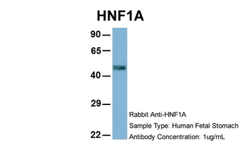 HNF1A Rabbit Polyclonal Antibody