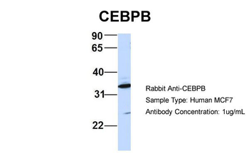 CEBPB Rabbit Polyclonal Antibody