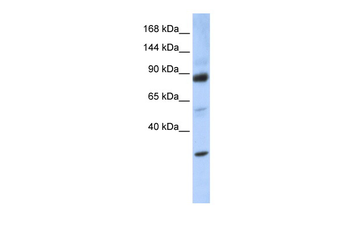 ZHX3 Rabbit Polyclonal Antibody