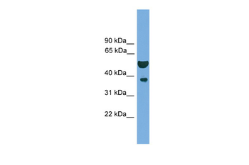 APEX1 Rabbit Polyclonal Antibody