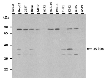 SIAH2 Rabbit Polyclonal Antibody