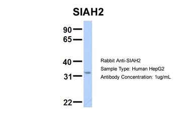 SIAH2 Rabbit Polyclonal Antibody