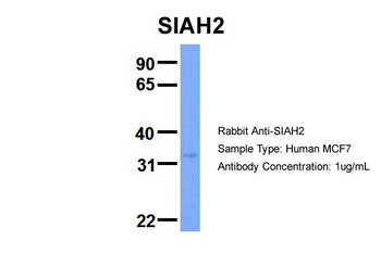 SIAH2 Rabbit Polyclonal Antibody