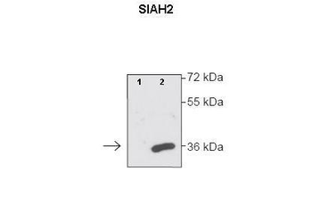 SIAH2 Rabbit Polyclonal Antibody