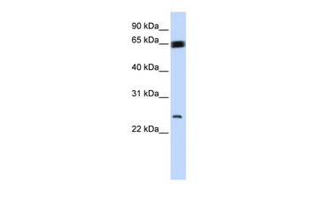KLF9 Rabbit Polyclonal Antibody
