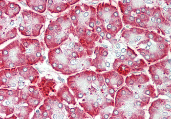 CALR Rabbit Polyclonal Antibody