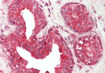 CALR Rabbit Polyclonal Antibody