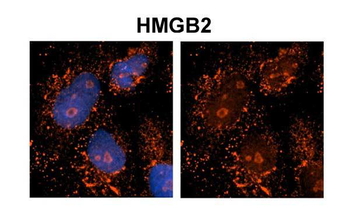 HMGB2 Rabbit Polyclonal Antibody