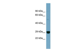 HMGB2 Rabbit Polyclonal Antibody
