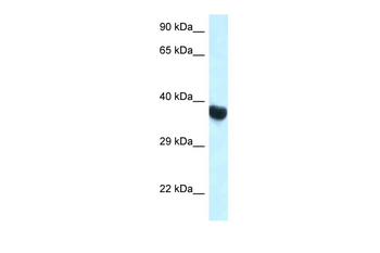 Hoxa10 Rabbit Polyclonal Antibody
