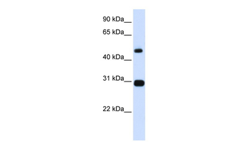 PSMC3 Rabbit Polyclonal Antibody