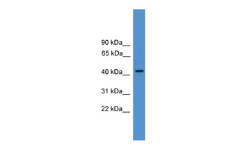 PSMC3 Rabbit Polyclonal Antibody