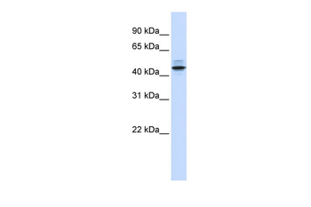 PSMC3 Rabbit Polyclonal Antibody