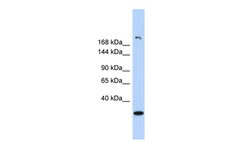 UTY Rabbit Polyclonal Antibody