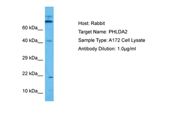 PHLDA2 Rabbit Polyclonal Antibody