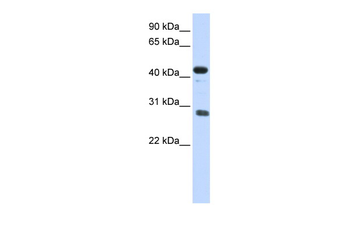 CDCA5 Rabbit Polyclonal Antibody
