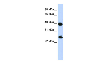 H2AFY Rabbit Polyclonal Antibody