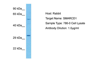 SMARCD1 Rabbit Polyclonal Antibody