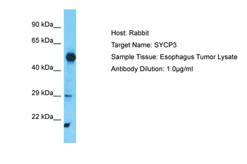 SYCP3 Rabbit Polyclonal Antibody
