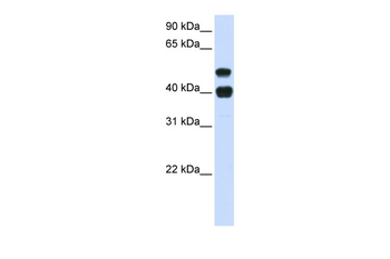 USP22 Rabbit Polyclonal Antibody