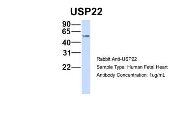 USP22 Rabbit Polyclonal Antibody