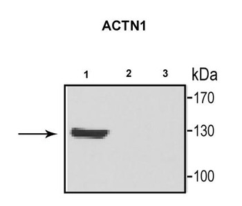 ACTN1 Rabbit Polyclonal Antibody