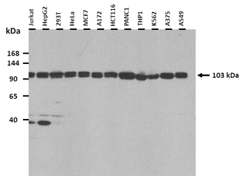 ACTN1 Rabbit Polyclonal Antibody