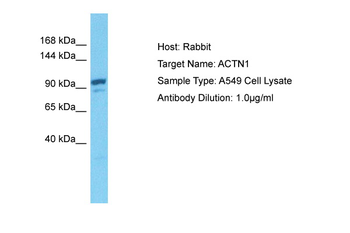 ACTN1 Rabbit Polyclonal Antibody