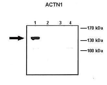 ACTN1 Rabbit Polyclonal Antibody