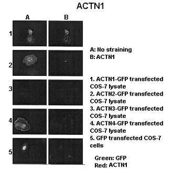 ACTN1 Rabbit Polyclonal Antibody