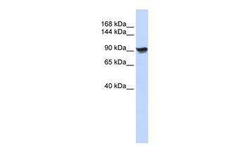ACTN1 Rabbit Polyclonal Antibody