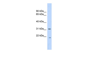 CAPNS1 Rabbit Polyclonal Antibody