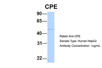 CPE Rabbit Polyclonal Antibody