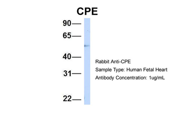 CPE Rabbit Polyclonal Antibody