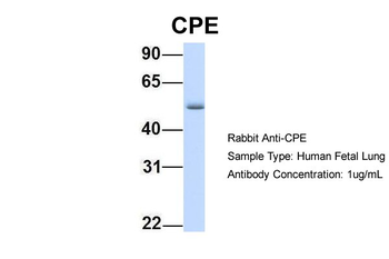 CPE Rabbit Polyclonal Antibody