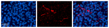 CPE Rabbit Polyclonal Antibody