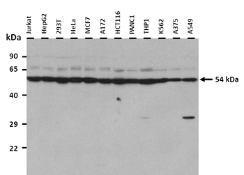 DLD Rabbit Polyclonal Antibody